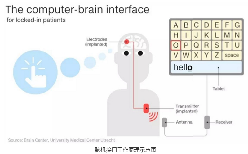 脑机接口新突破，精神疾病治疗的新希望